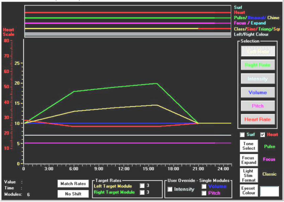 SMR/Beta session for ADD treatment – protocol for ADHD children (MindAlive, 2022)
